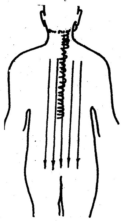 Back Guasha Therapy