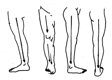 Four-limb Gua Sha Therapy