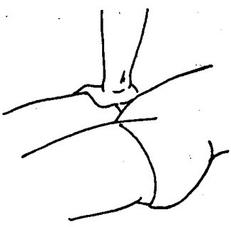 Kneading and pressing the anterior superior iliac spine