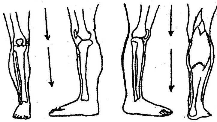 Knee Joint Gua Sha Therapy